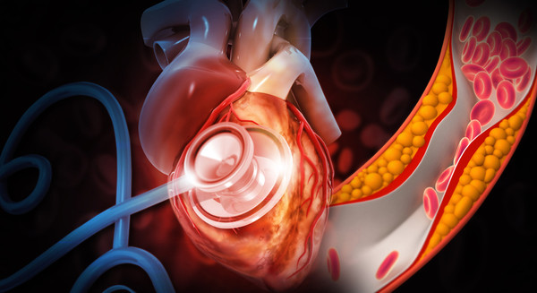 풍치(치주염, 잇몸내려앉음)가 당뇨를 악화시킨다구요? 네. 그럴 수 있습니다. 관련 이미지 4