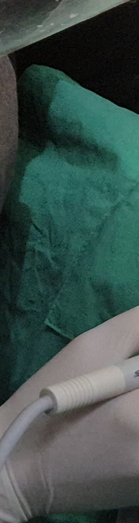 한티역치과 임플란트, 뼈이식 꼭 해야 할까? <의사 답변> 관련 이미지 12