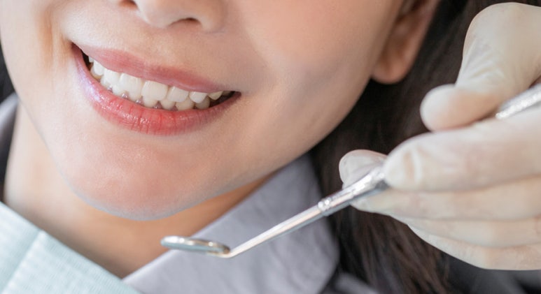 라미네이트색상, 모양 후회 안하려면? 관련 이미지 7