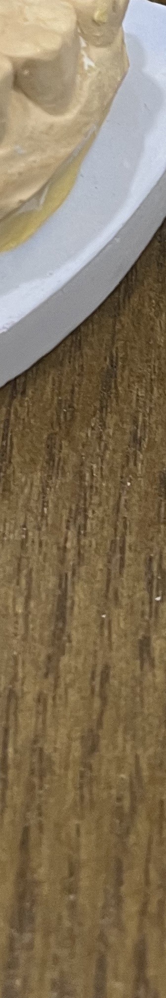 매봉역 치과, 자연치아 잃고 싶지 않다면? 관련 이미지 19