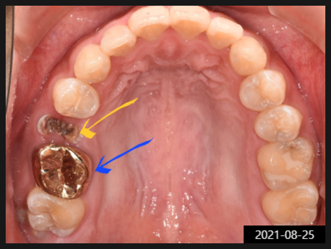 선정릉역치과, 합리적인 비용? 의사가 알려드립니다 관련 이미지 7