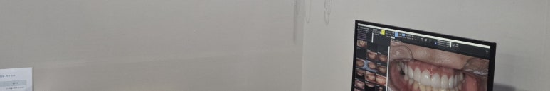 선릉역치과, 치아미백 후기보다 중요한 것 2가지 관련 이미지 12