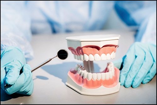 앞니브릿지가격? 치과의사가 말하는 포인트 1가지 관련 이미지 4