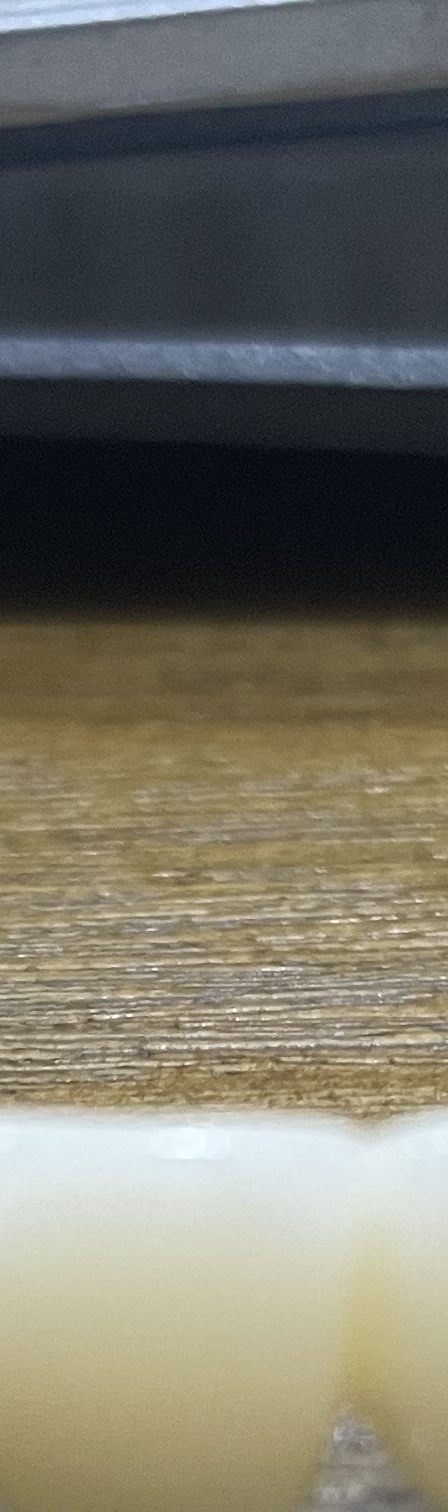 서초동 치과, 통증이 두려워 방문을 꺼리신다면? 관련 이미지 8