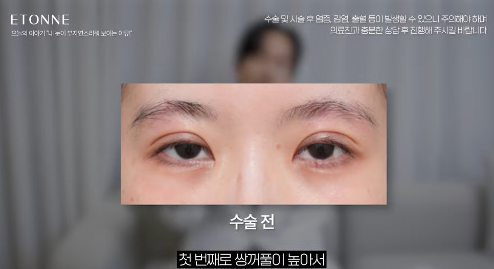 [EtonTV] How to Make Your Eyes Look Prettier Without Looking Like You Had Plastic Surgery image 7
