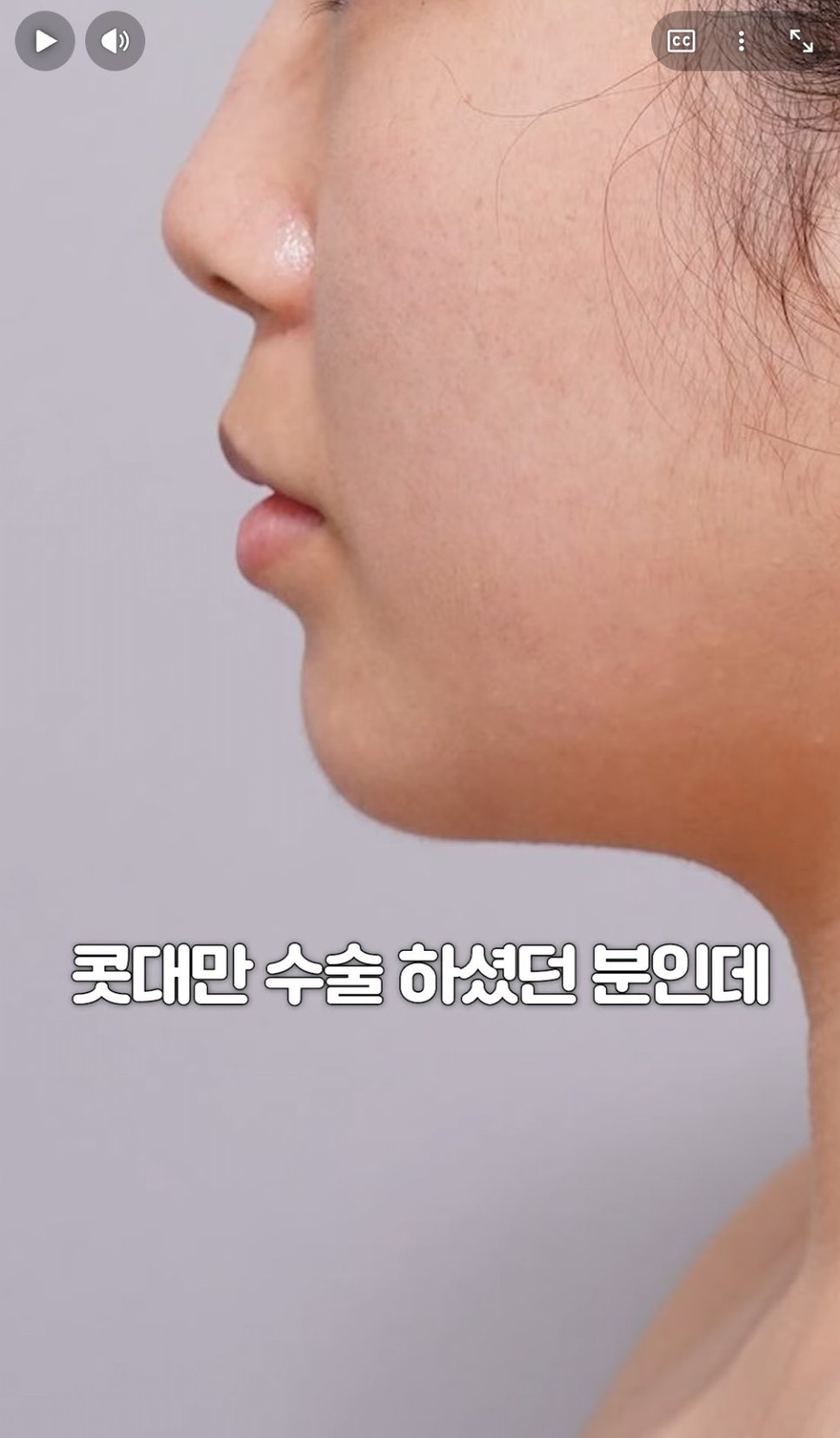 [에톤TV] 아름다운 코의 비밀은 &lsquo;콧대와 코끝&rsquo;의 밸런스 관련 이미지 2