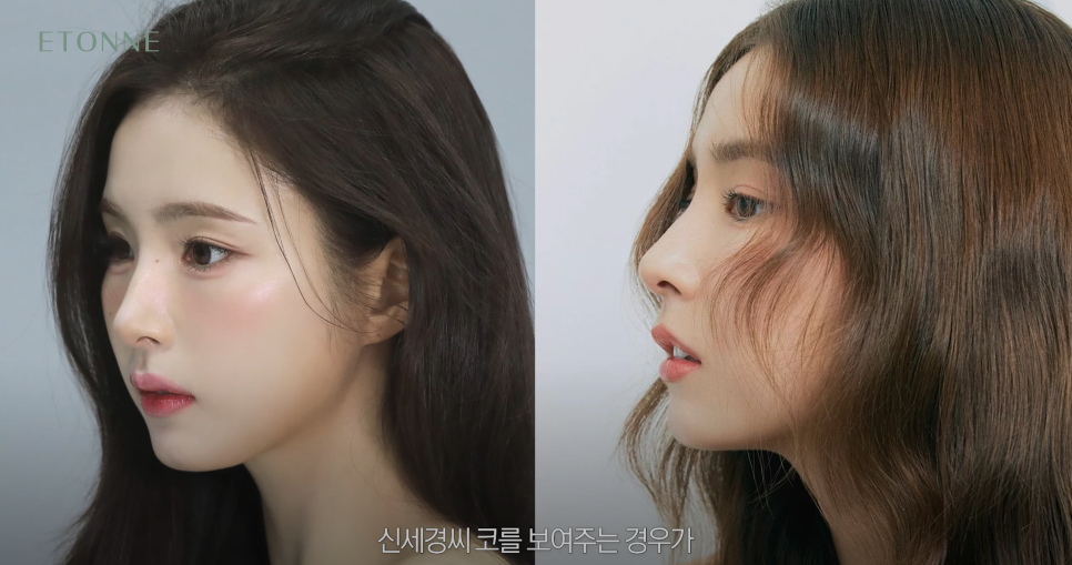 [에톤TV] 남자 vs 여자, 코 성형의 핵심! 콧대와 코끝의 중요성 관련 이미지 8