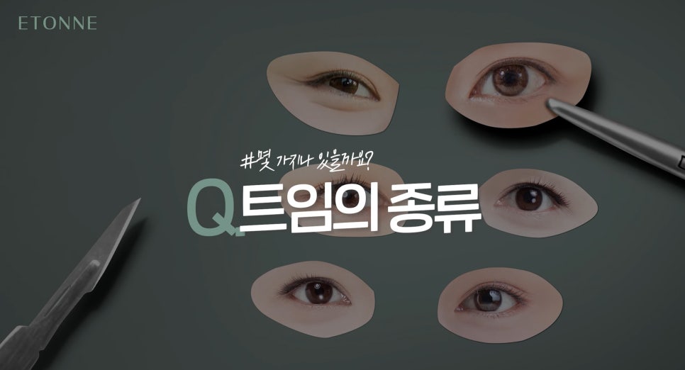 [에톤TV] 트임성형의 종류와 부작용 관련 이미지 2