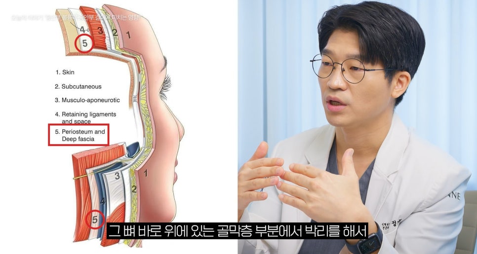 [Eton TV] Even just making the cheekbones softer can make the face look shorter image 2