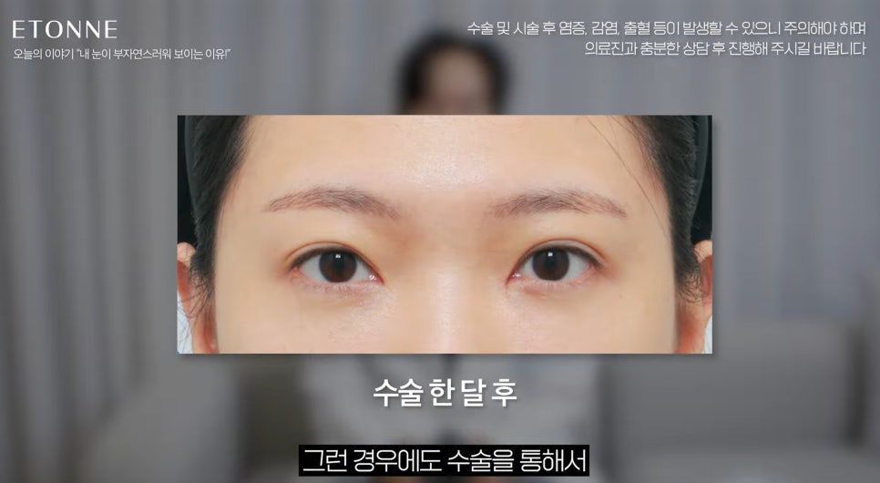 [EtonTV] How to Make Your Eyes Look Prettier Without Looking Like You Had Plastic Surgery image 12