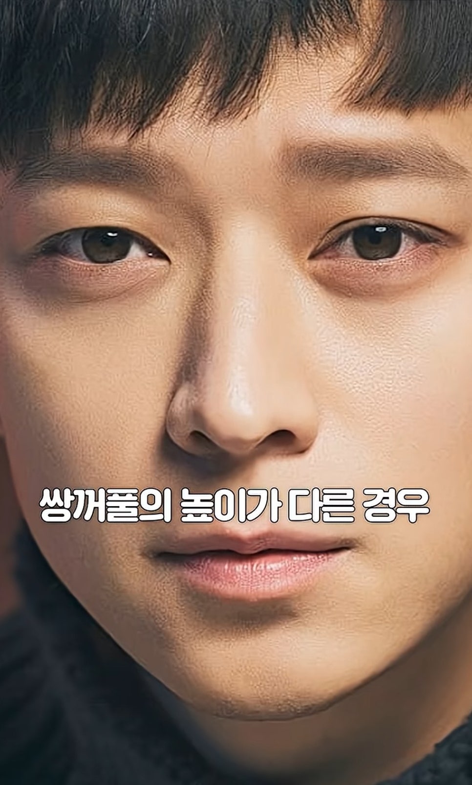 [에톤TV] &lsquo;짝눈&rsquo;의 고민 해결 방법 관련 이미지 2