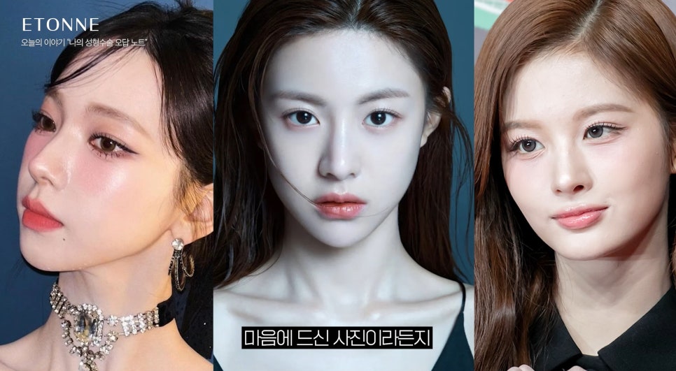 [에톤TV] 솔직하게 기록해보는 수술 실패 오답 노트 관련 이미지 8