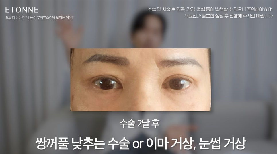 [EtonTV] How to Make Your Eyes Look Prettier Without Looking Like You Had Plastic Surgery image 10
