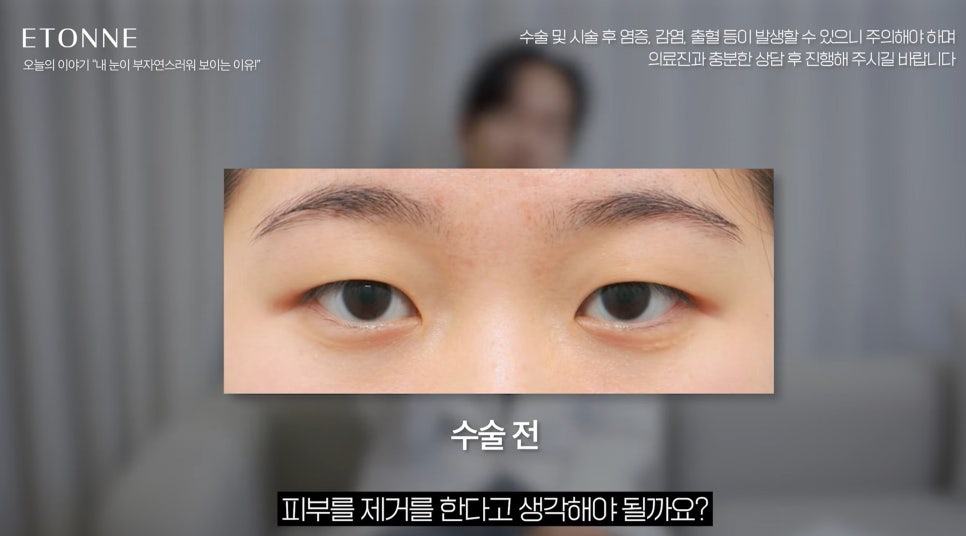 [EtonTV] How to Make Your Eyes Look Prettier Without Looking Like You Had Plastic Surgery image 16
