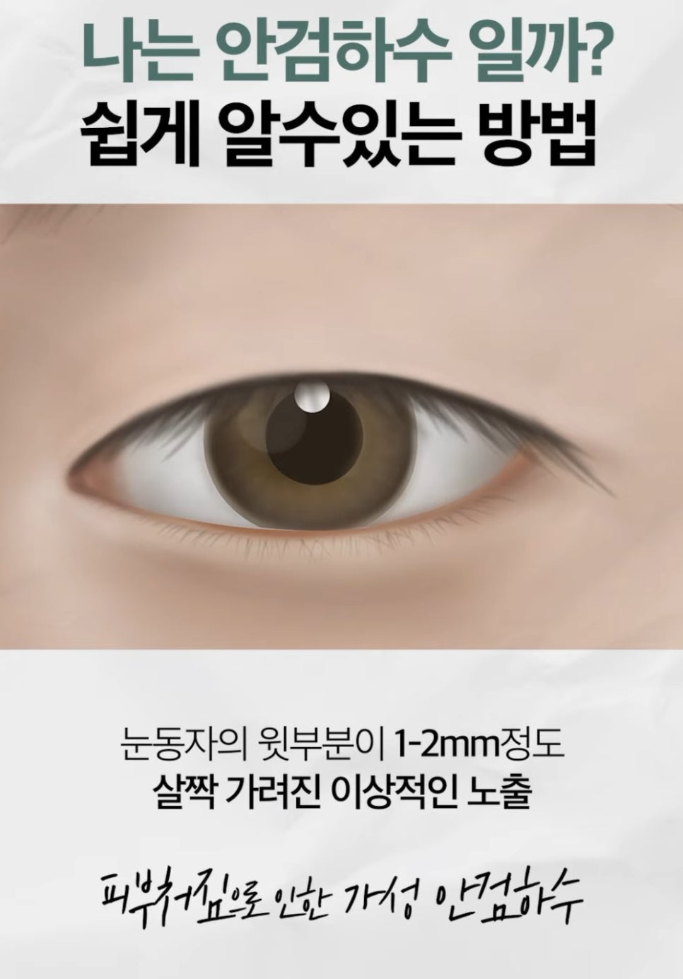 [에톤TV] 안검하수를 진단하는 가장 쉬운 방법 관련 이미지 4