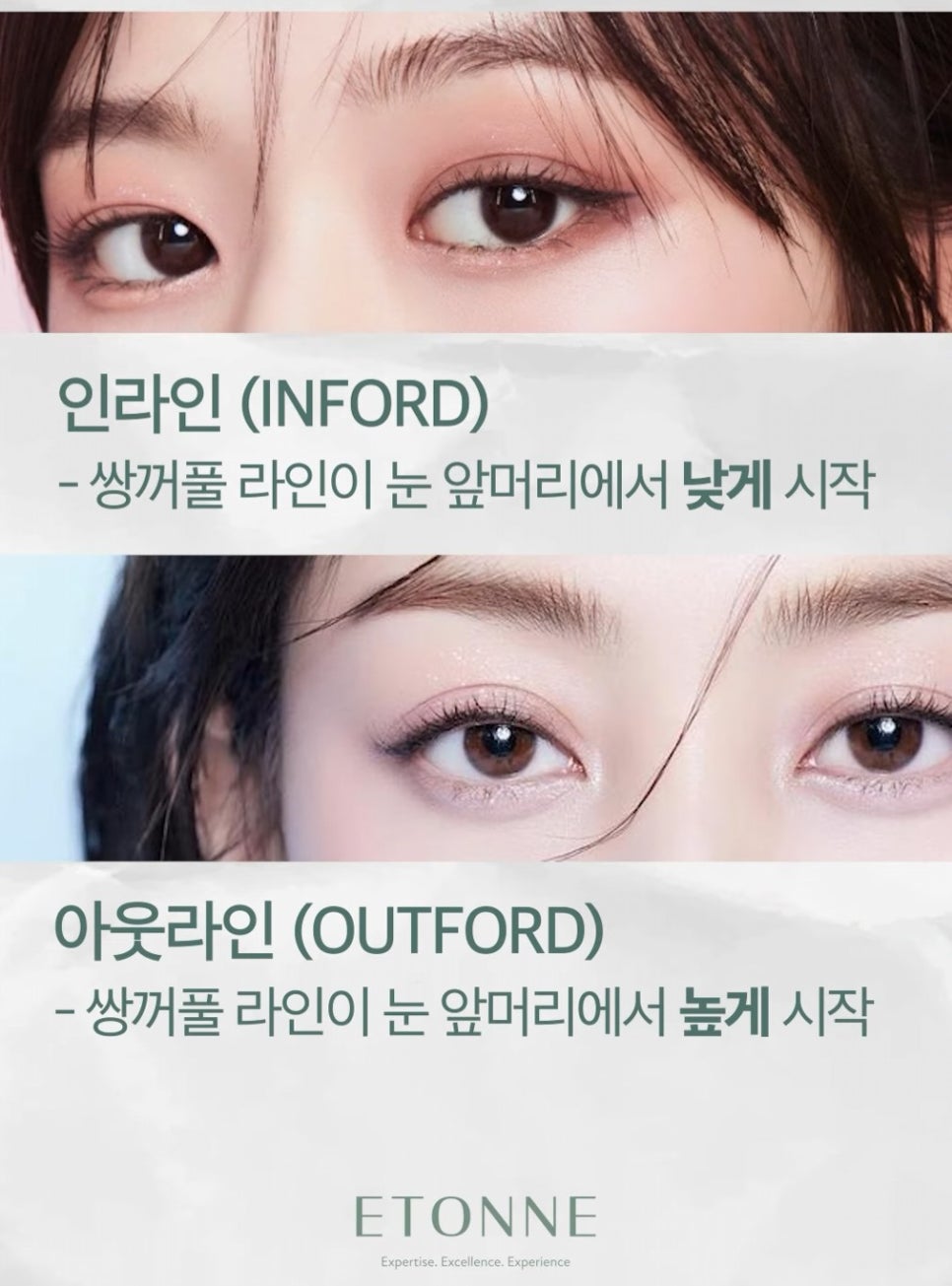 [EtonTV] Eyes That Suit Semi Outlined Double Eyelids Well image 2