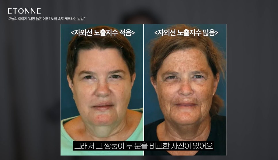 [에톤TV] 노안과 동안은 유전자일까? 관리의 결과일까? 관련 이미지 2