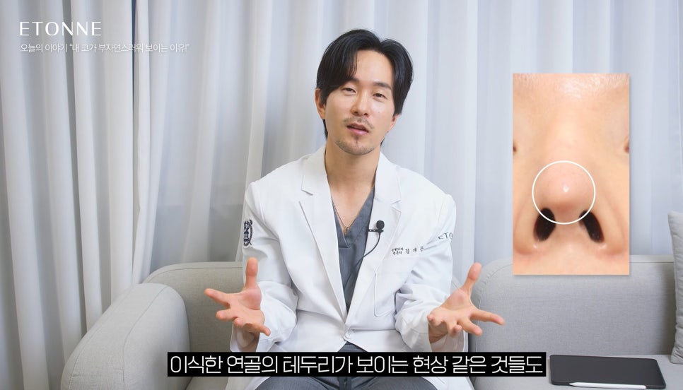 [Etone TV] Why a surgically enhanced nose can look unnatural image 5