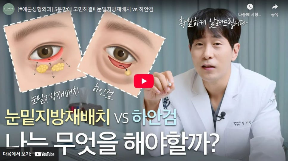 [EtonTV] Solve Your Under-Eye Concerns! Which Surgery Do I Need? (Under-Eye Fat Repositioning vs. Lower Blepharoplasty) image 1