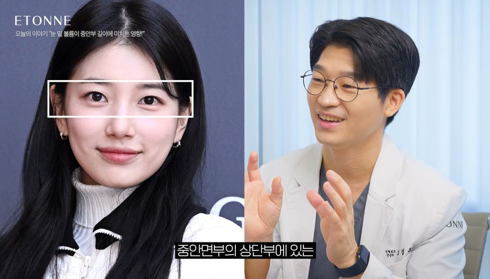 [Etone TV] The Effect of Under-Eye Volume on Midface Length image 2