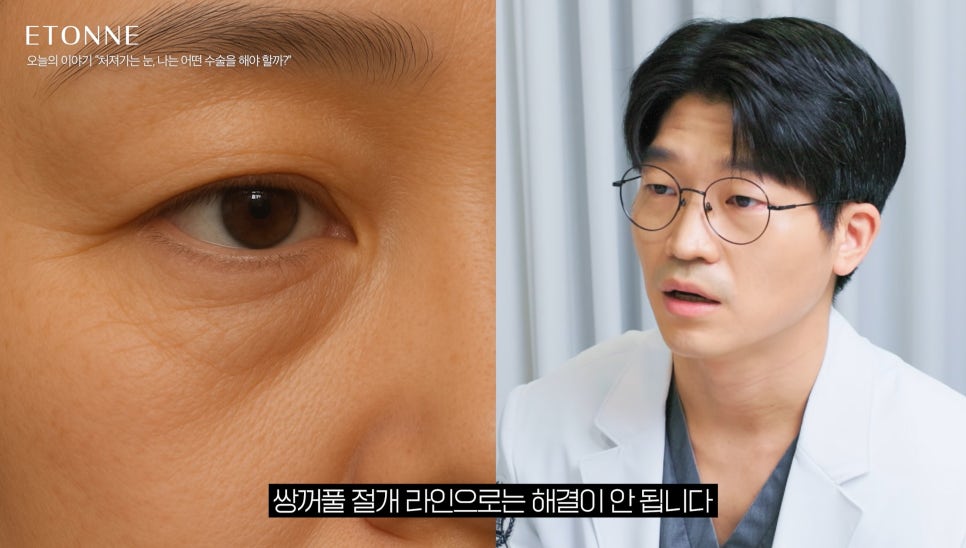 [Eton TV] Sleepy Eyes, Tired Expression! 3 Ways to Improve Drooping Eyelids image 6