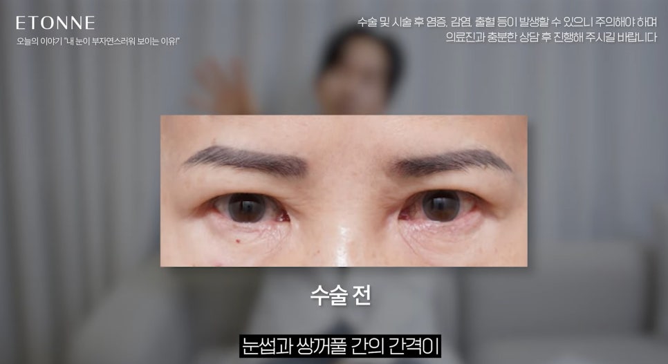 [EtonTV] How to Make Your Eyes Look Prettier Without Looking Like You Had Plastic Surgery image 9