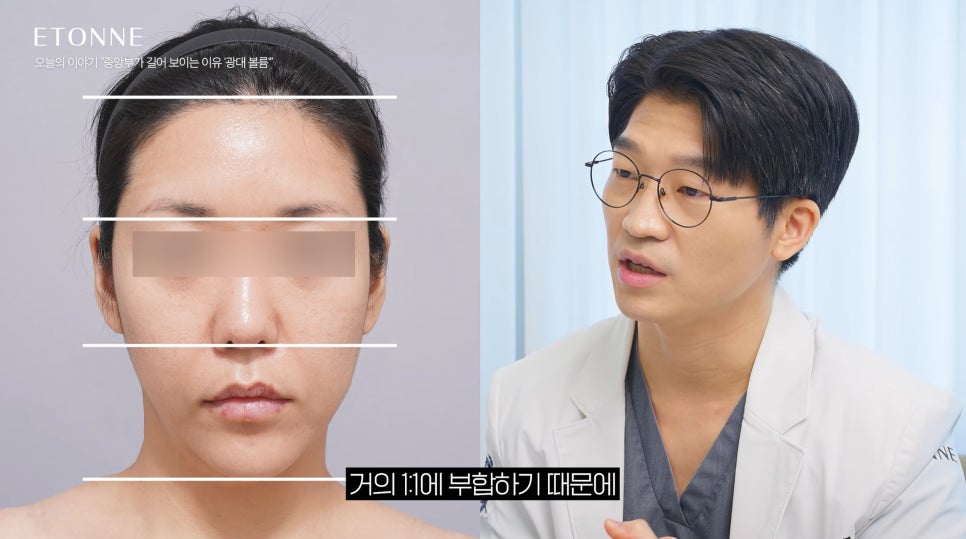 [에톤TV] 수술 없이 가능한, 중안면부 짧아 보이는 꿀팁 관련 이미지 2