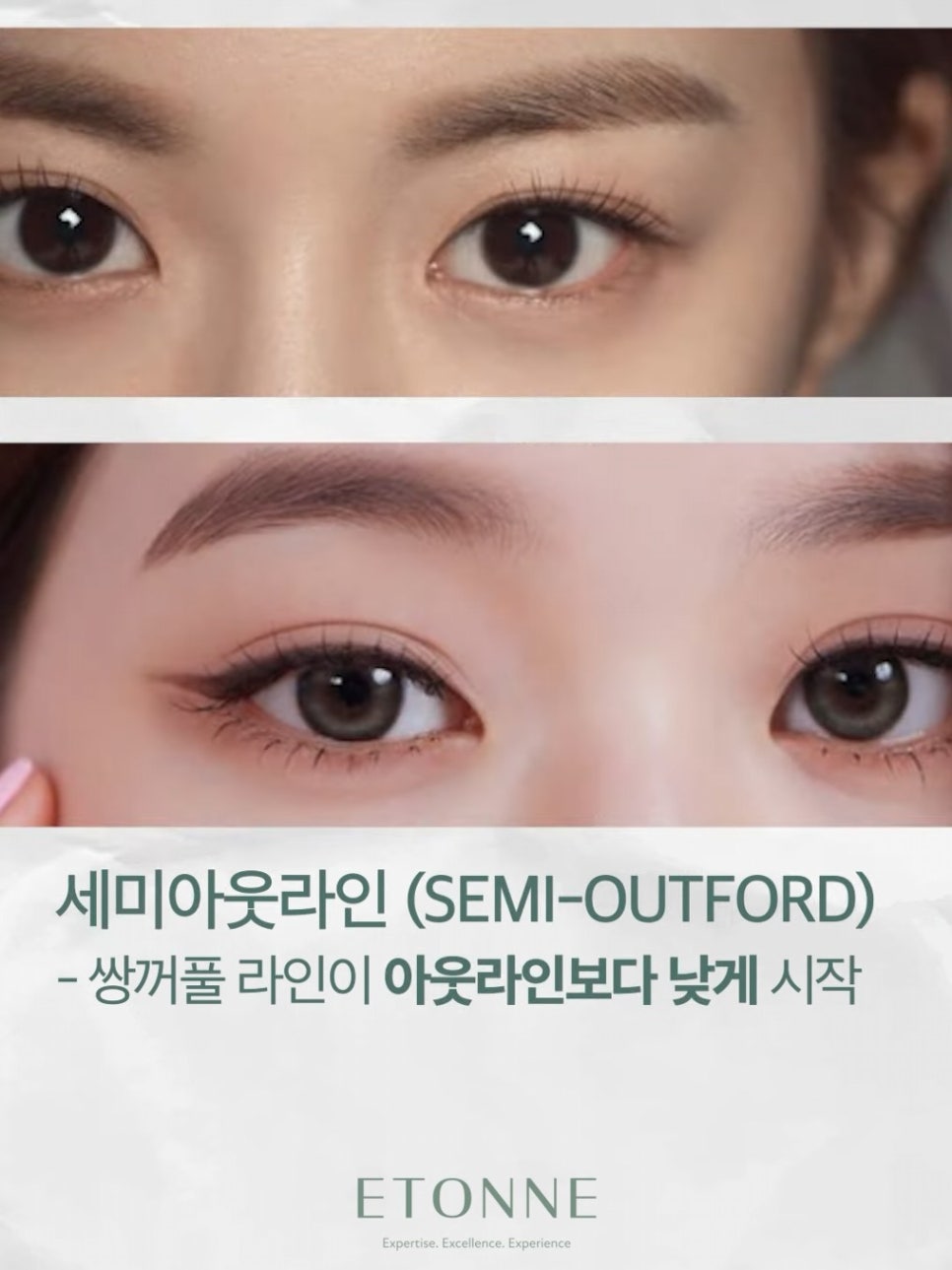 [EtonTV] Eyes That Suit Semi Outlined Double Eyelids Well image 3