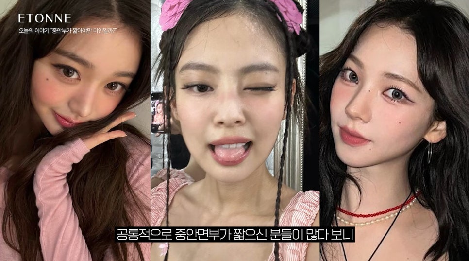 [Etone TV] The reasons behind the obsession with the “midface” and its real effects, as explained by a plastic surgeon image 5