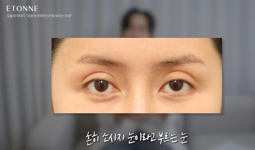 [EtonTV] How to Make Your Eyes Look Prettier Without Looking Like You Had Plastic Surgery image 4