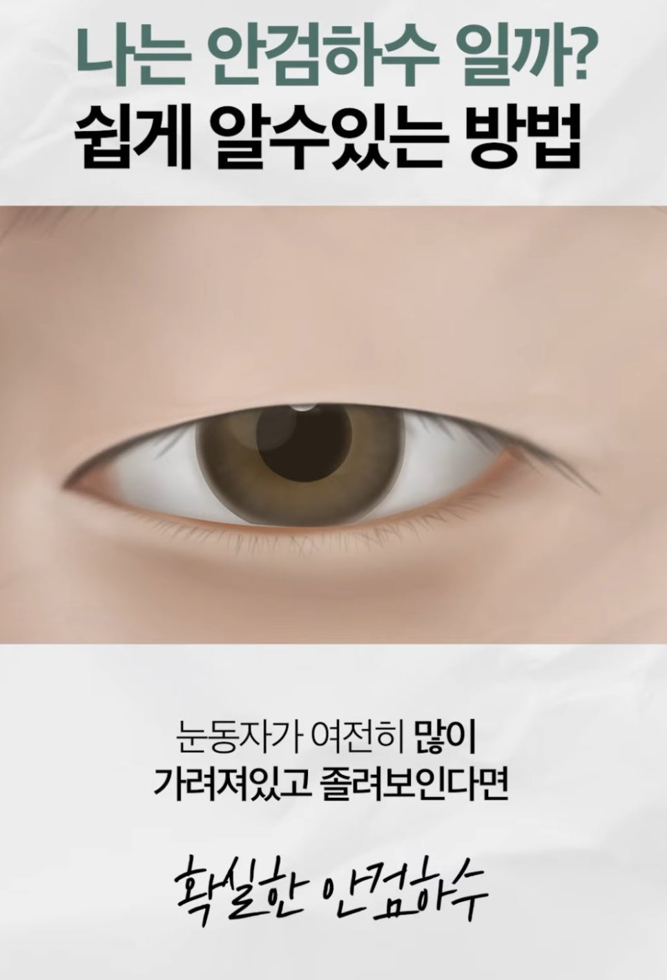 [에톤TV] 안검하수를 진단하는 가장 쉬운 방법 관련 이미지 5