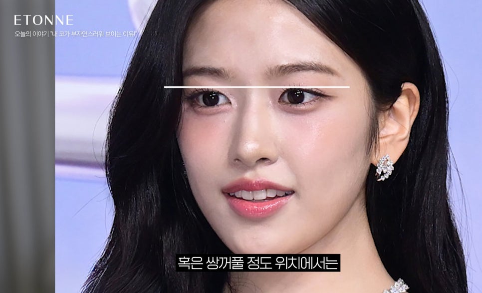 [Etone TV] Why a surgically enhanced nose can look unnatural image 4