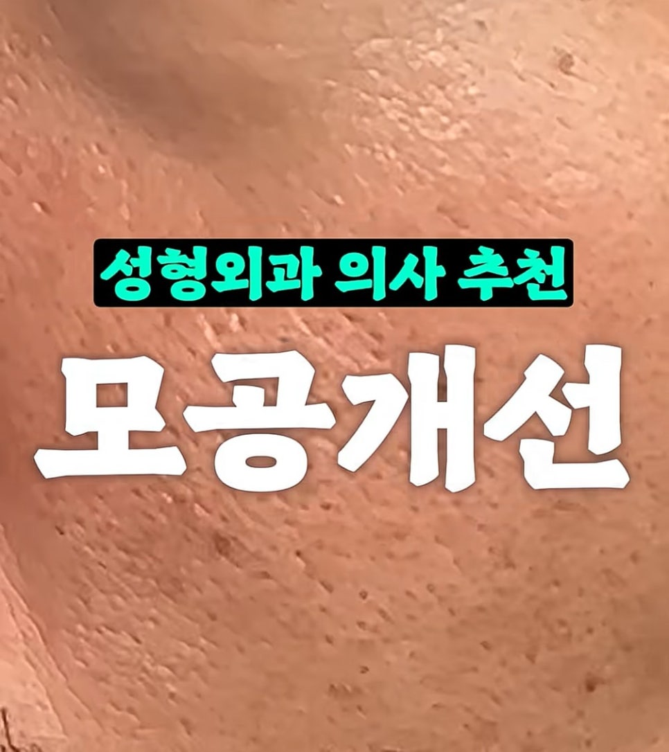 [에톤TV] 모공 개선이 필요할 때, 이렇게 해보세요! (성형외과 의사 추천) 관련 이미지 1