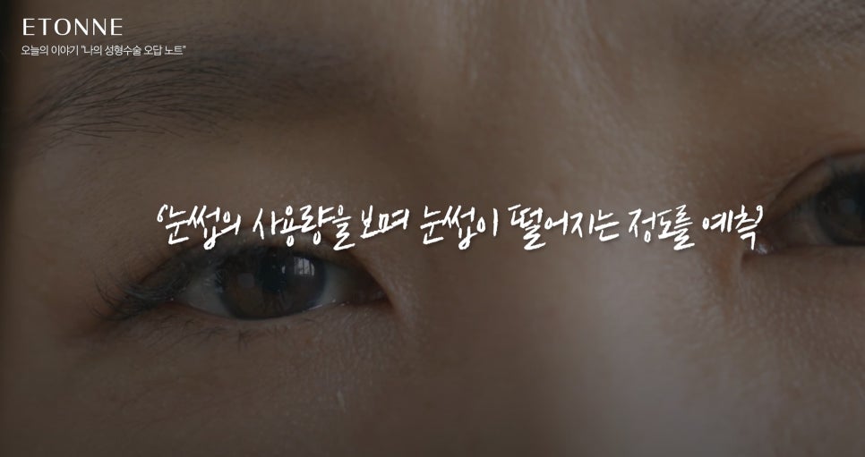 [에톤TV] 솔직하게 기록해보는 수술 실패 오답 노트 관련 이미지 6