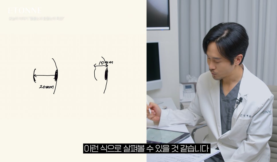 [에톤TV] 돌출눈과 함몰눈의 특징 관련 이미지 3