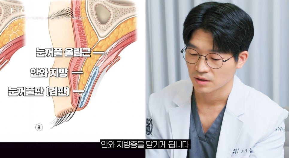 [Eton TV] Sleepy Eyes, Tired Expression! 3 Ways to Improve Drooping Eyelids image 3