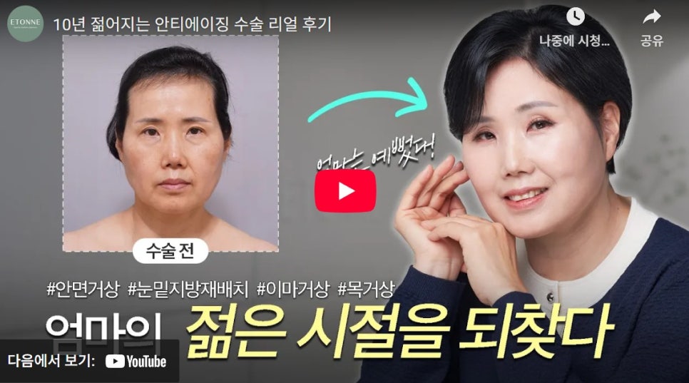 [Eton TV] A Housewife in Her 60s Shares Her Anti-Aging Surgery Review After Looking 10 Years Younger image 1