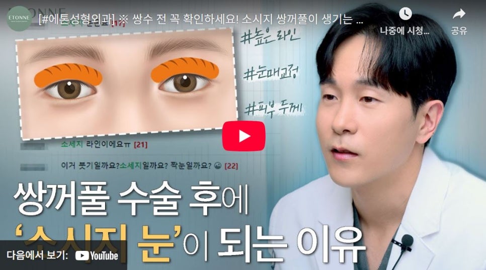 [Eton TV] After Double Eyelid Surgery image 1