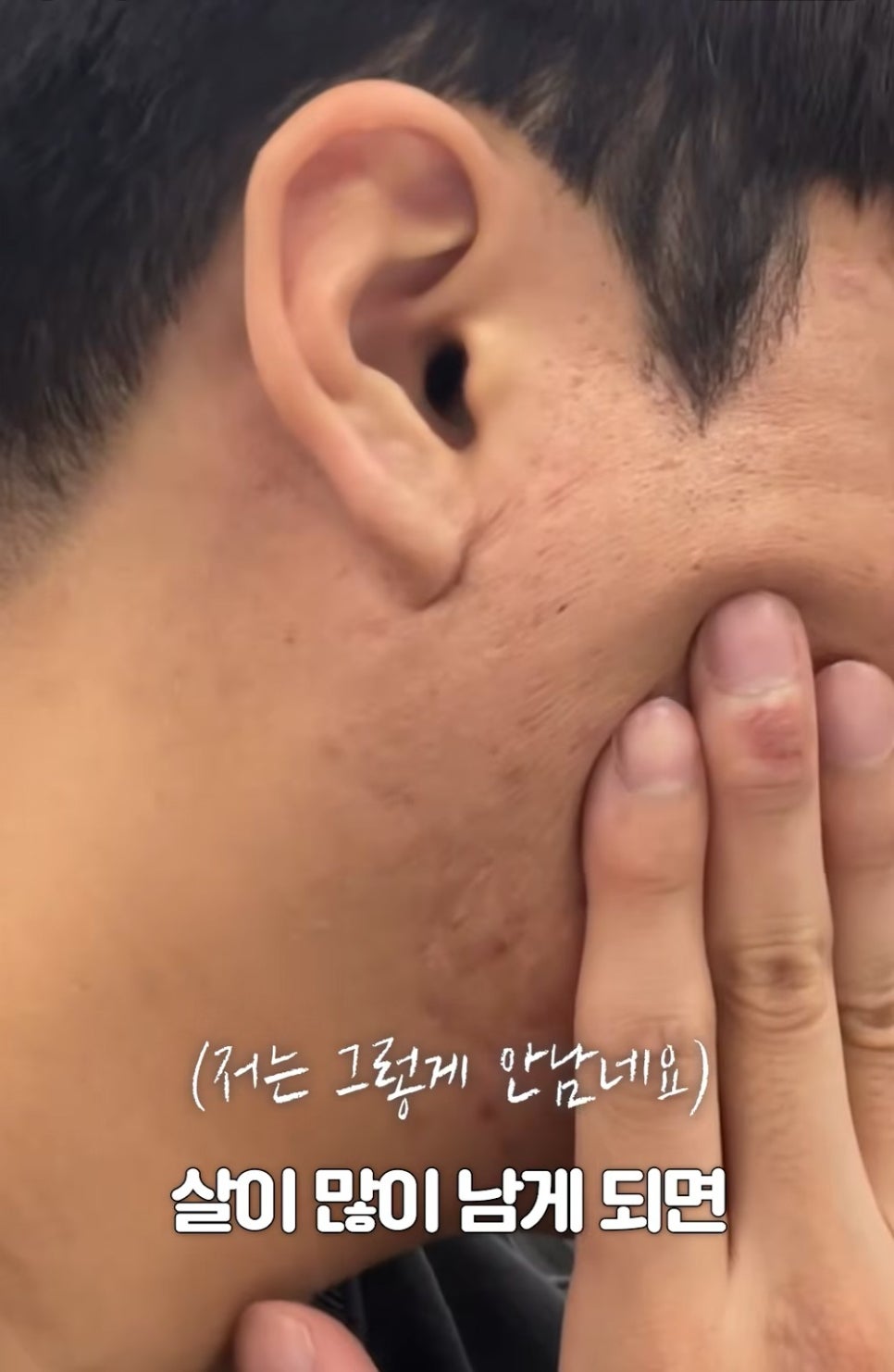 [에톤TV] 처진 피부, 어떻게 해결해야 할까? 나에게 맞는 리프팅 시술 찾기! 관련 이미지 2