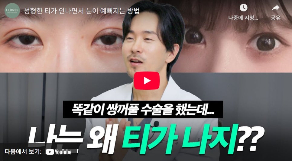 [EtonTV] How to Make Your Eyes Look Prettier Without Looking Like You Had Plastic Surgery image 1