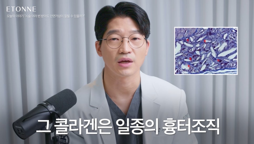 [Eton TV] Even After Multiple Thread-Lifting Procedures image 3