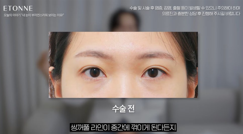 [EtonTV] How to Make Your Eyes Look Prettier Without Looking Like You Had Plastic Surgery image 11