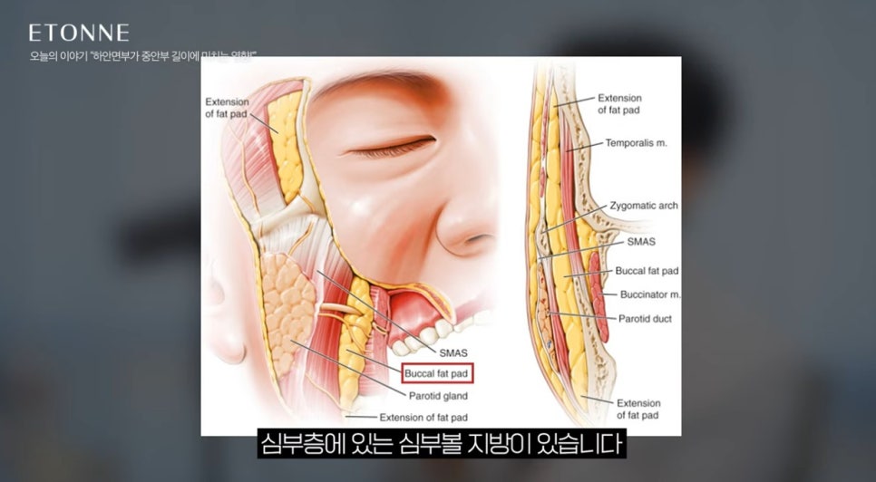 [Eton TV] The Effect of the Lower Face on the Length of the Midface image 2