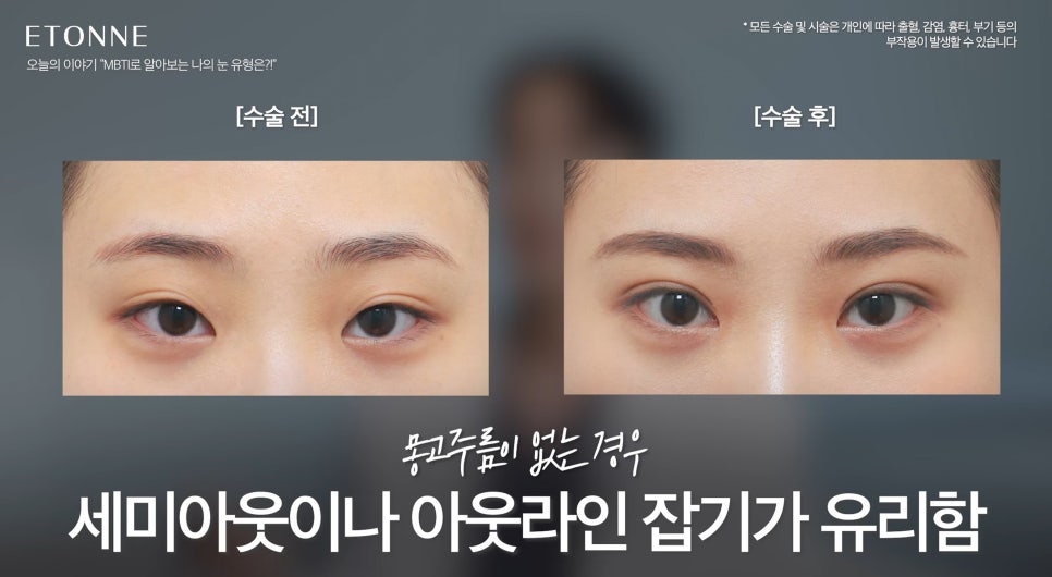 [에톤TV] What Is My Eye Type According to Eye MBTI? image 7