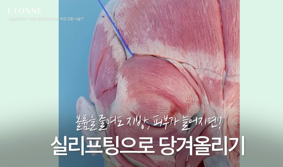 [에톤TV] 처진 피부에 효과 보는 최강 조합 시술은? 관련 이미지 2