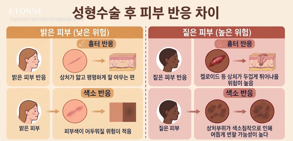 [에톤TV] 해외 VIP들이 한국 성형외과를 찾는 이유 관련 이미지 2