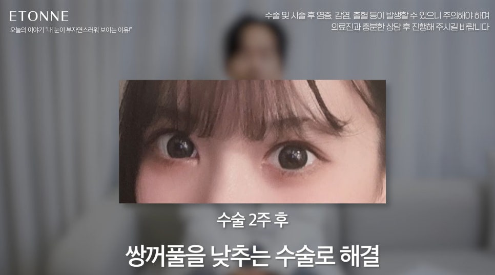 [EtonTV] How to Make Your Eyes Look Prettier Without Looking Like You Had Plastic Surgery image 8