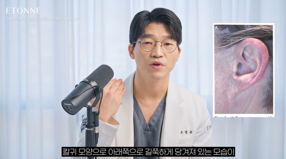 [Eton TV] What Are the Effects of Revision Facelift Surgery? image 7