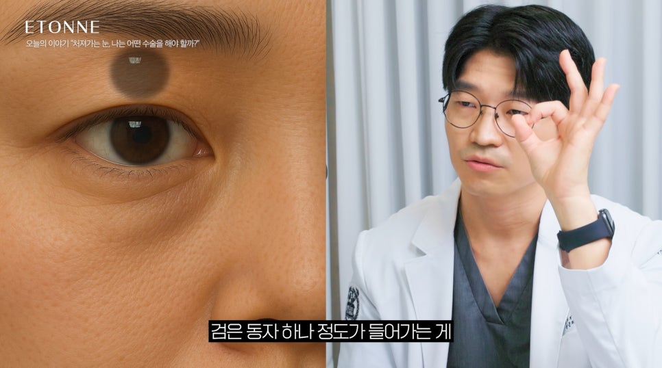 [Eton TV] Sleepy Eyes, Tired Expression! 3 Ways to Improve Drooping Eyelids image 8