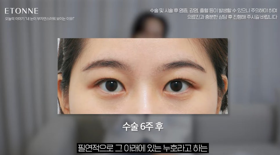 [EtonTV] How to Make Your Eyes Look Prettier Without Looking Like You Had Plastic Surgery image 17